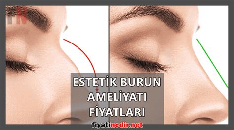 Burun Eti Ameliyatı Fiyatları: 2024 Güncel Fiyatlandırma