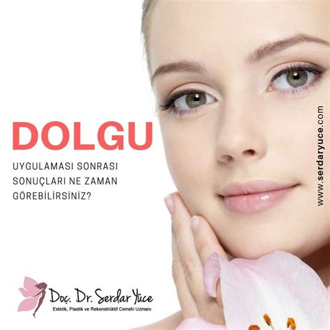 Dolgu Sonrası Beklenen Sonuçlar