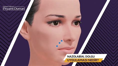 Dolgu uygulaması nasıl yapılır?