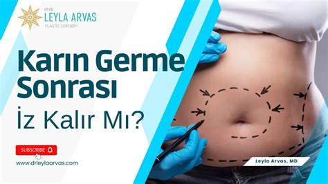 Karın Germe: Ameliyat Sonrası Bakım ve İyileşme