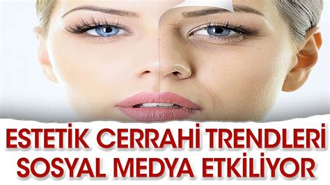 Sosyal Medya ve Kaş Kaldırma Ameliyatı: Trendler Nasıl Değişiyor?